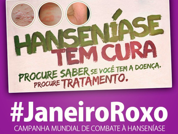 Janeiro Roxo: Fique atento aos principais sintomas da hanseníase